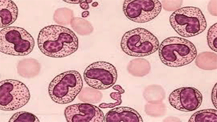 爱必梦生物科技有限公司案例细胞支原体污染